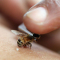 Апирефлексотерапия (пчелоужаление)
