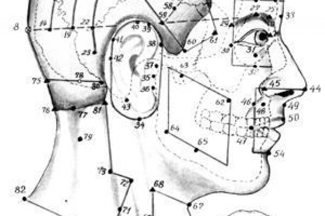 Иглоукалывание: область головы и шеи