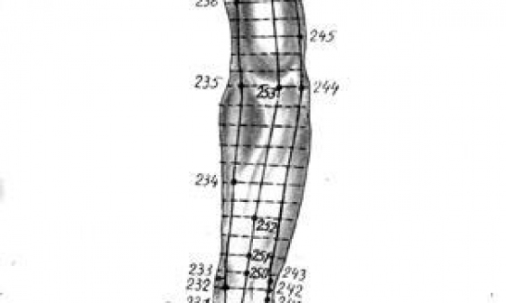 Иглоукалывание по областям тела: Верхняя конечность