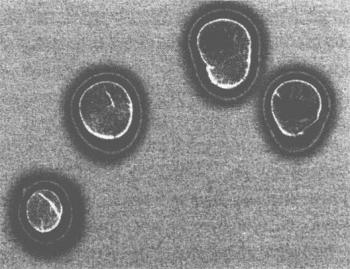 Кирлиан фото, после сеанса Рэйки