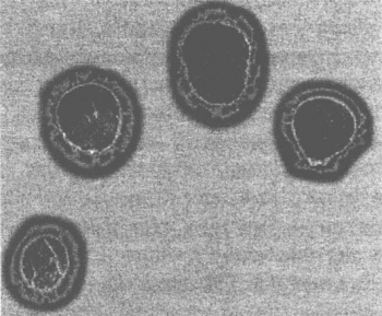 Кирлиан фото, после сеанса Рэйки