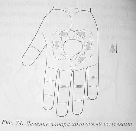 Су джок терапия семянотерапия и точки с картинками