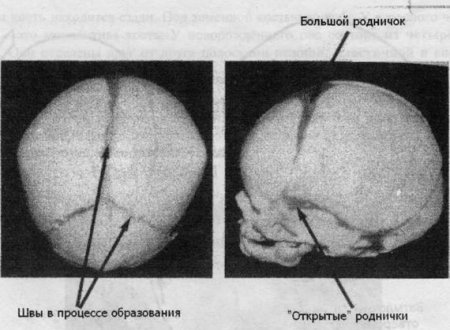 Остеопатия для новорожденных. Почему необходимо остеопатическое вмешательство?