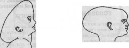 Остеопатия для новорожденных. Почему необходимо остеопатическое вмешательство?