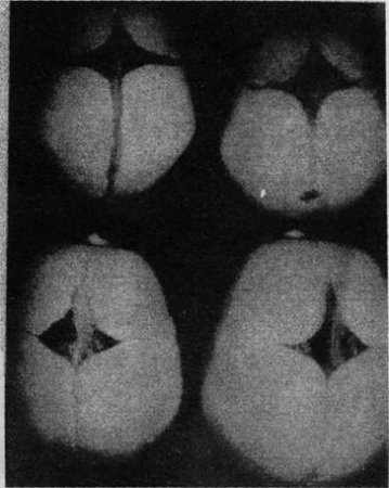 Остеопатия для новорожденных. Почему необходимо остеопатическое вмешательство?