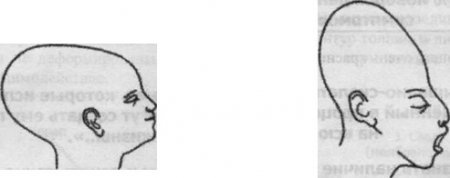 Остеопатия для новорожденных. Почему необходимо остеопатическое вмешательство?