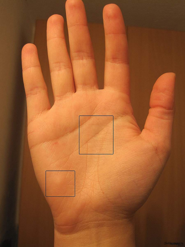Треугольник на линии жизни на правой руке что значит с фото